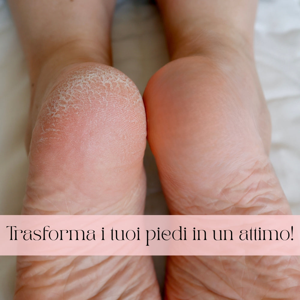 Glowify™ PRO - Piedi Lisci Subito