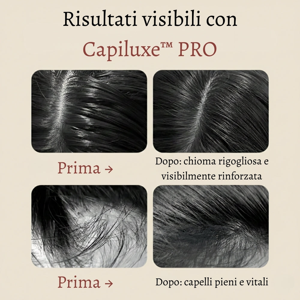 Capiluxe™ PRO - Capelli Più Forti e Cuoio Capelluto Più Sano