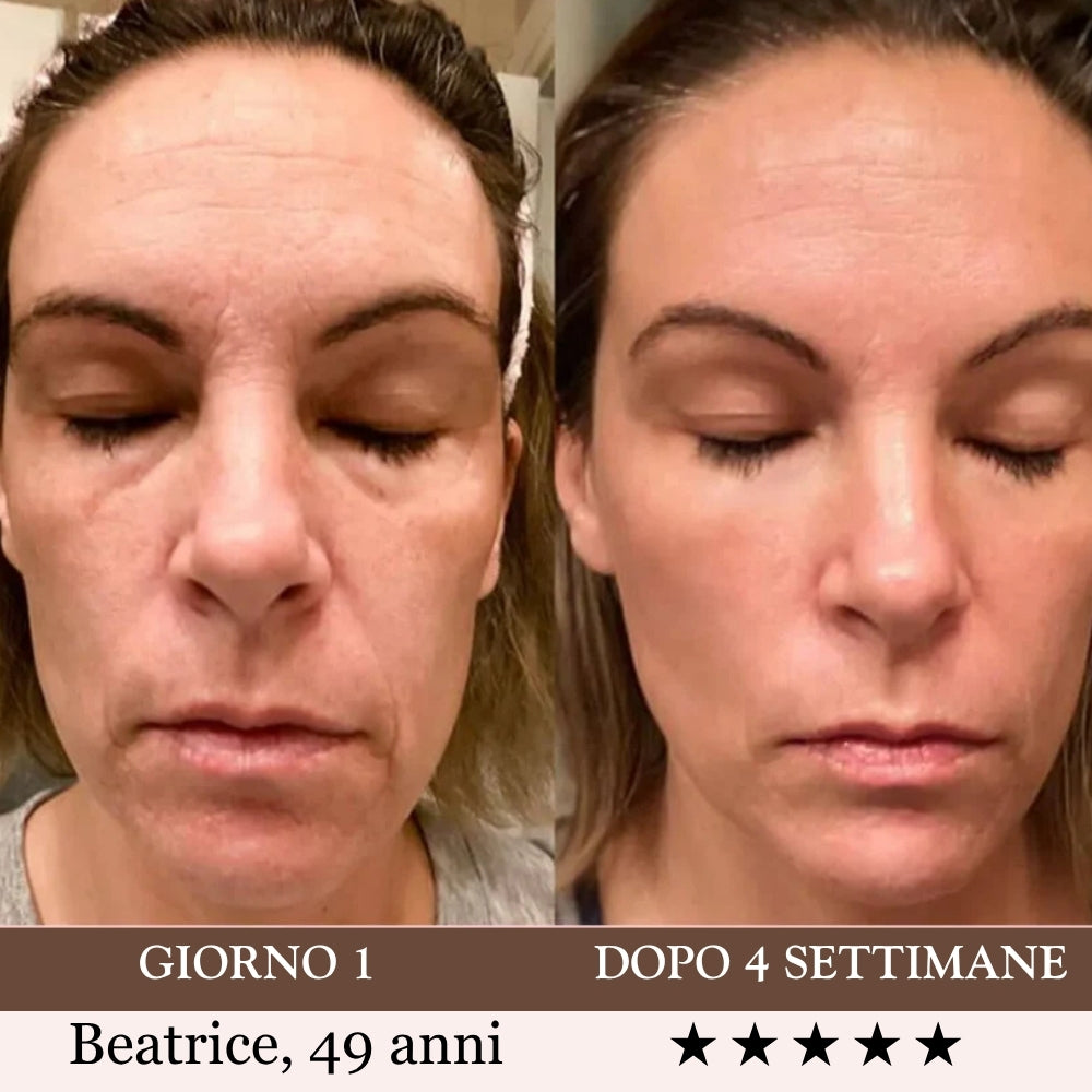 Luvéa™ PRO - Tonifica, Illumina, Leviga il Tuo Viso e Collo