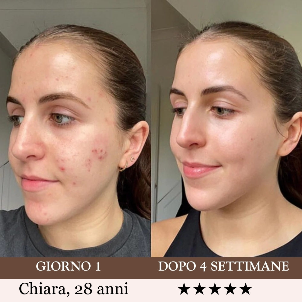 Luvéa™ PRO - Tonifica, Illumina, Leviga il Tuo Viso e Collo